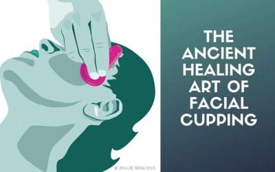 Cupping – an Ancient Chinese Practice Becomes the Hottest Trend